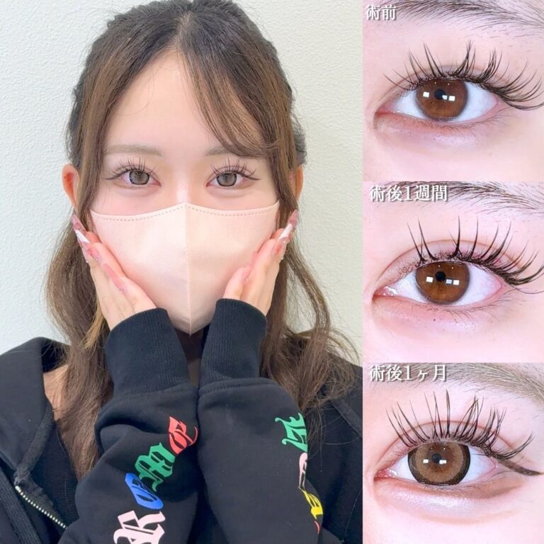 症例写真