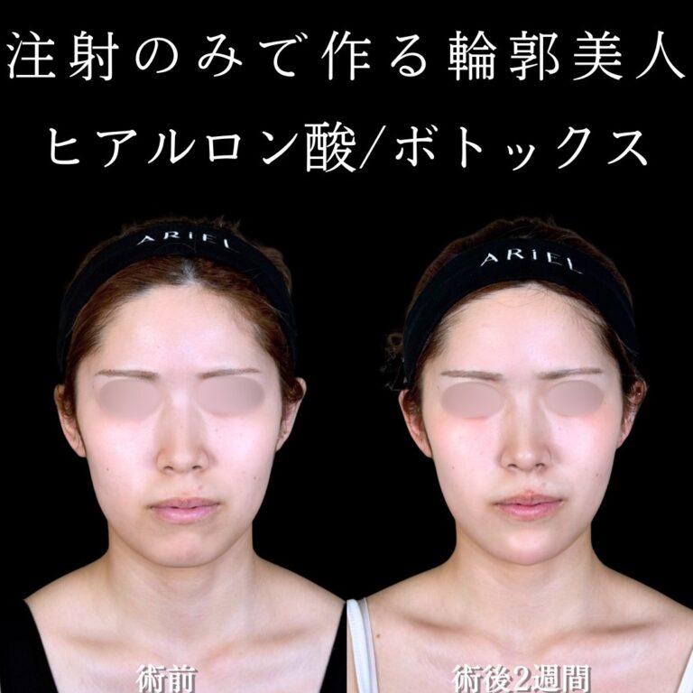 症例写真