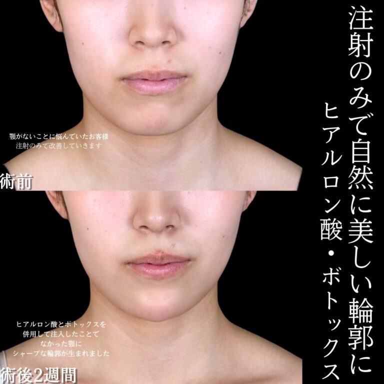 関連写真1