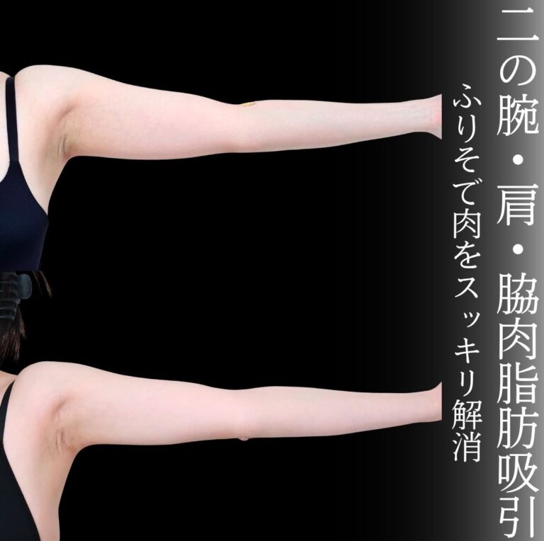 症例写真