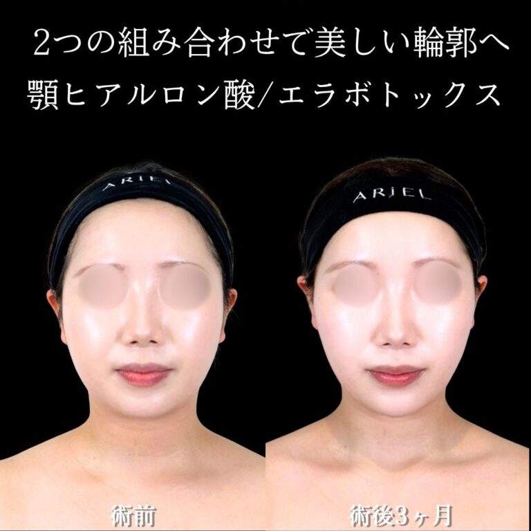 症例写真