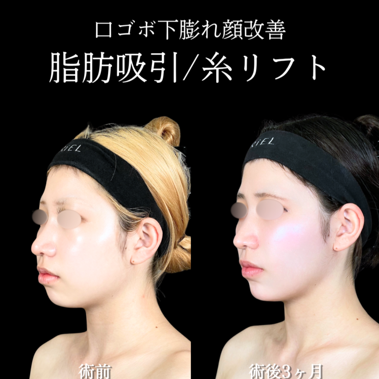 症例写真