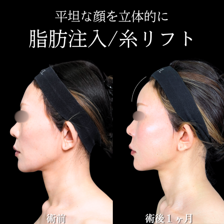 症例写真
