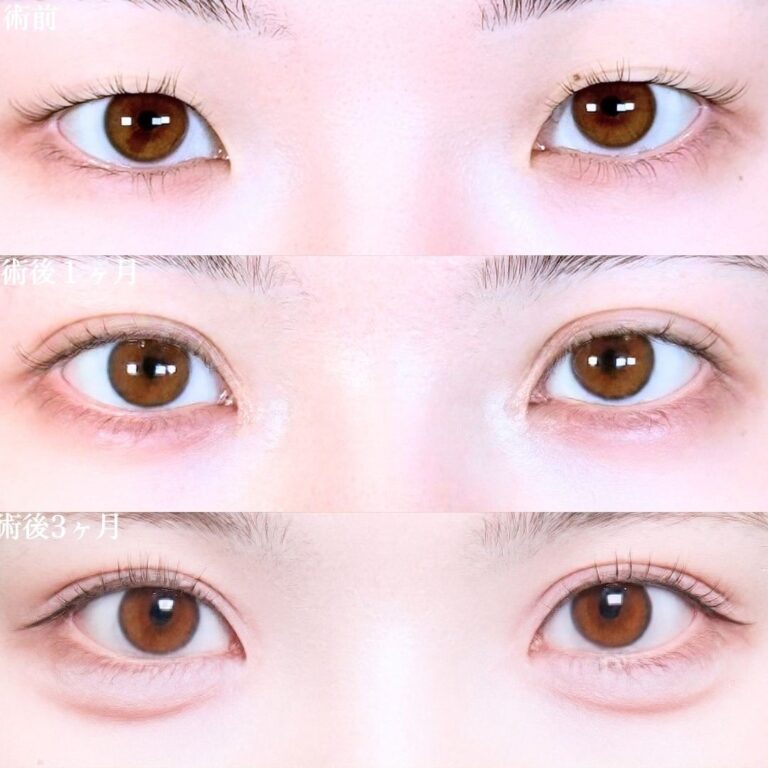 症例写真