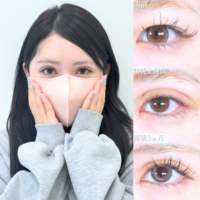 症例写真