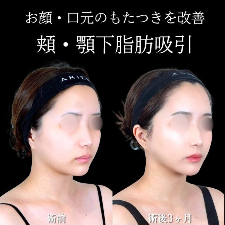 症例写真