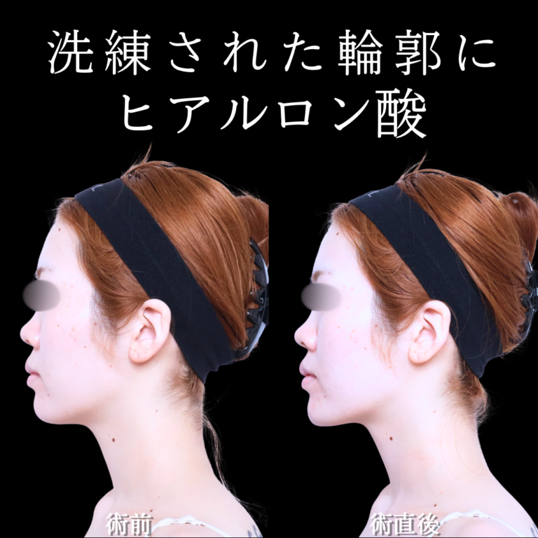 症例写真