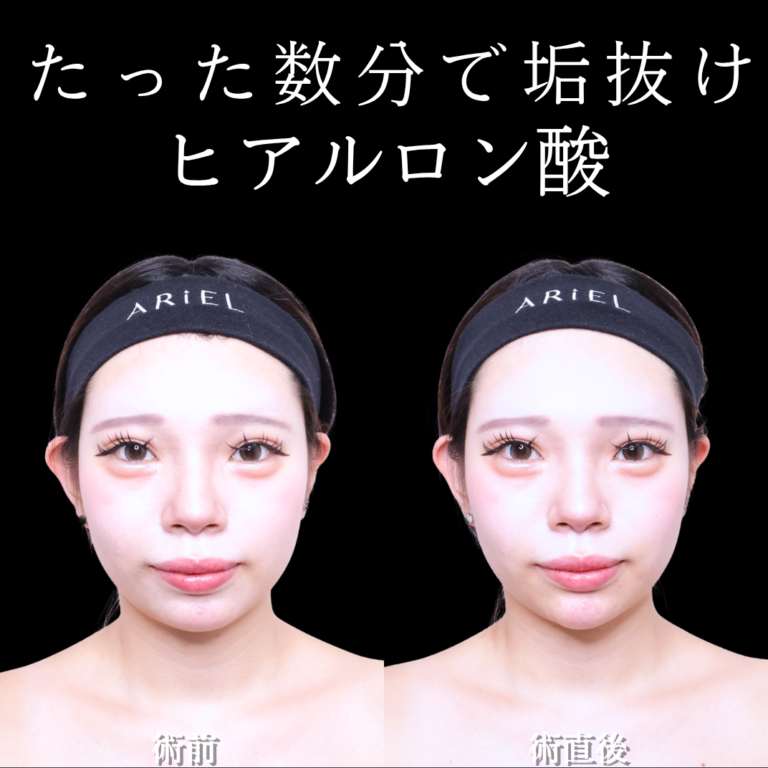 症例写真