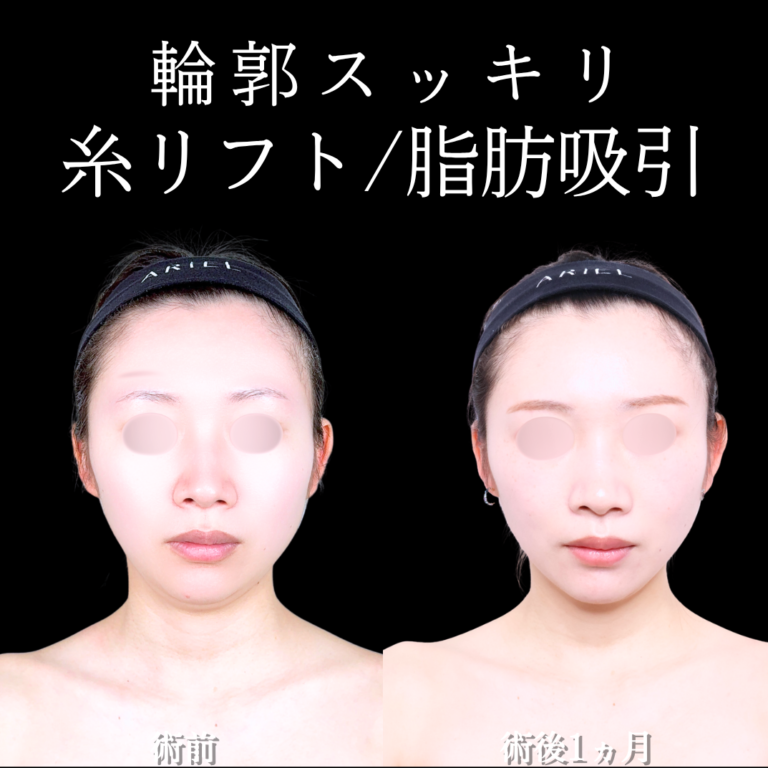 症例写真