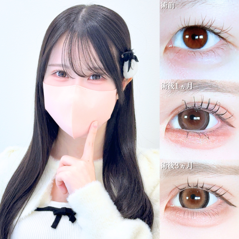 症例写真