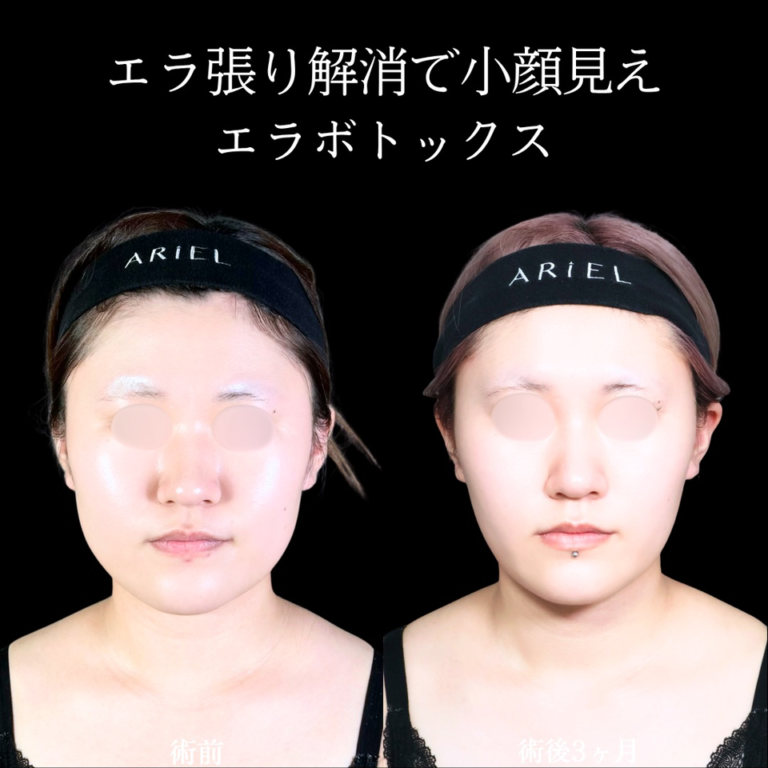 症例写真