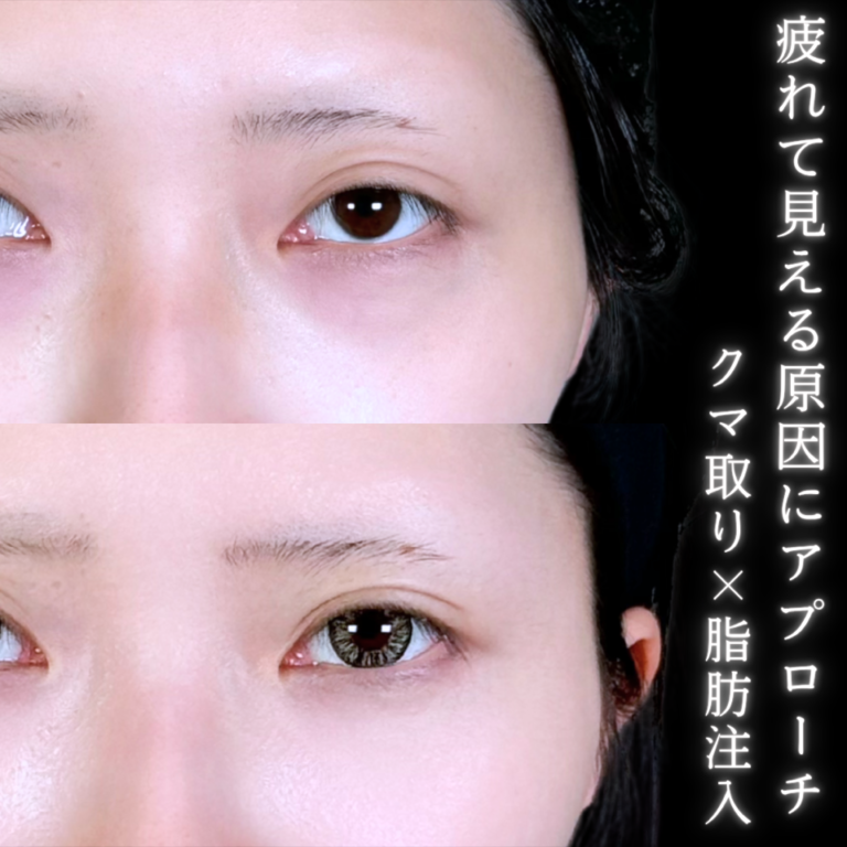 症例写真