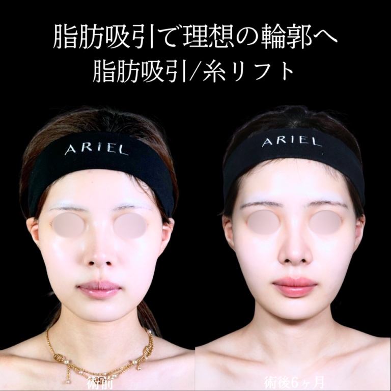 症例写真