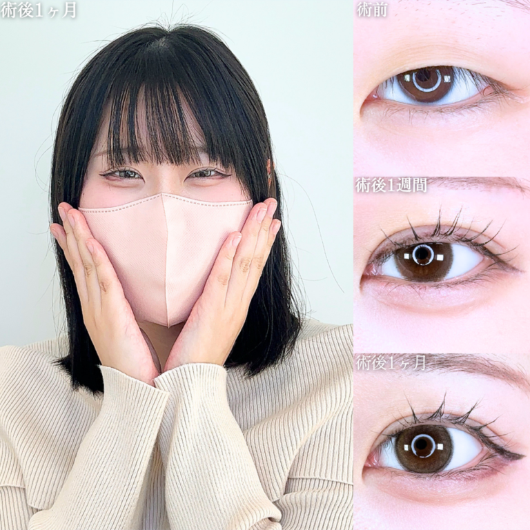 症例写真