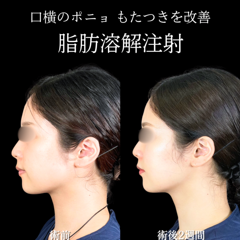 症例写真