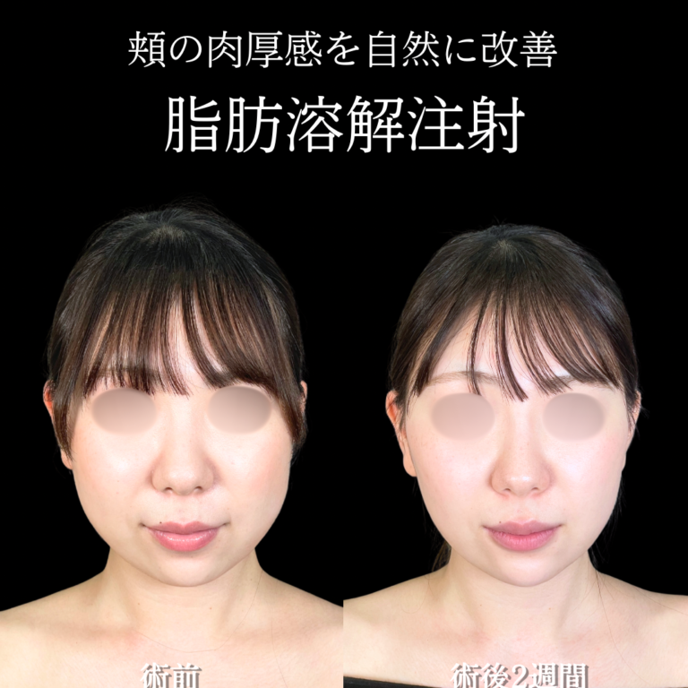 症例写真