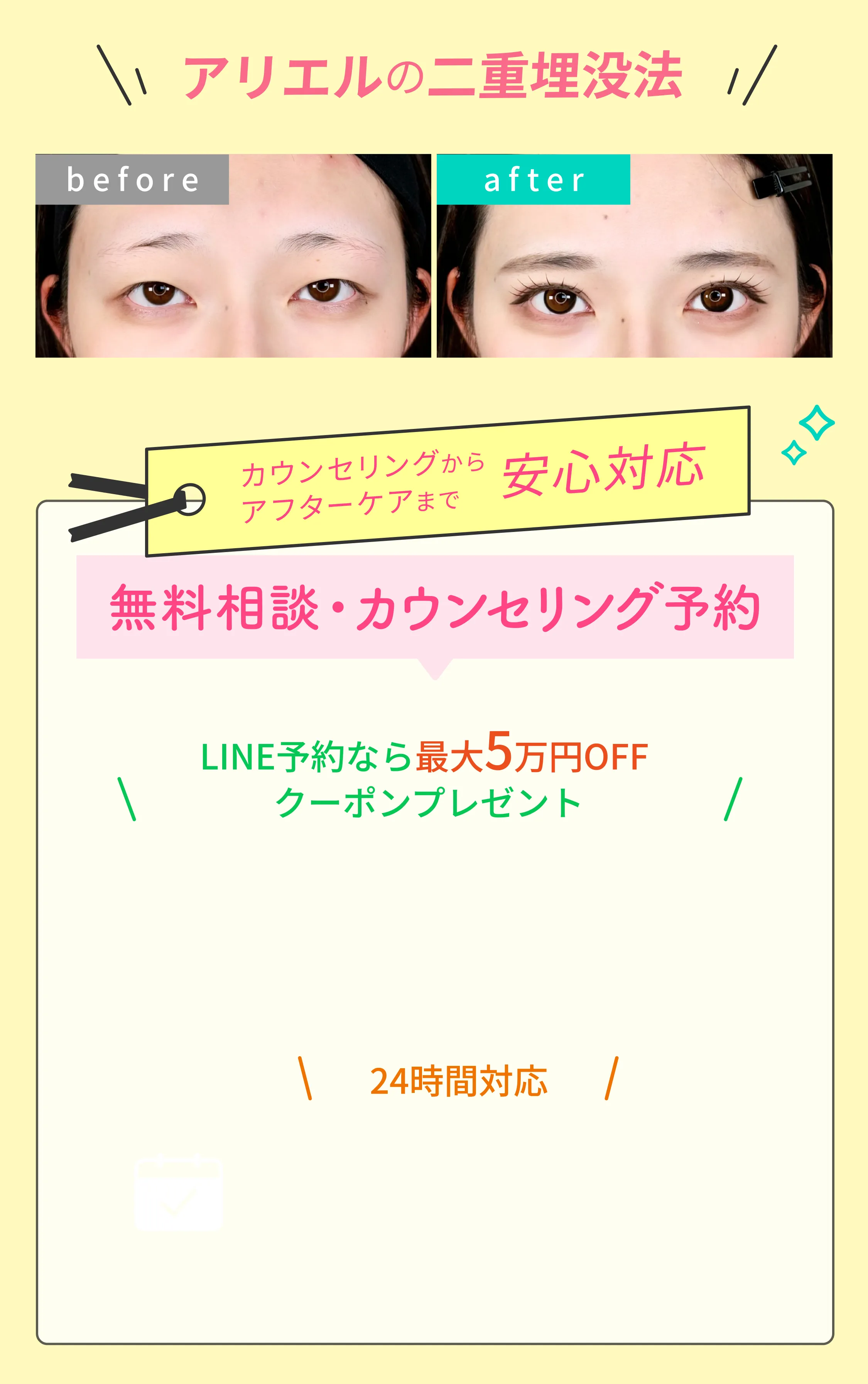 アリエルの二重埋没法ビフォーアフター写真 カウンセリングからアフターケアまで安心対応 無料相談・カウンセリング予約 LINE予約なら最大5万円OFFクーポンプレゼント 24時間対応