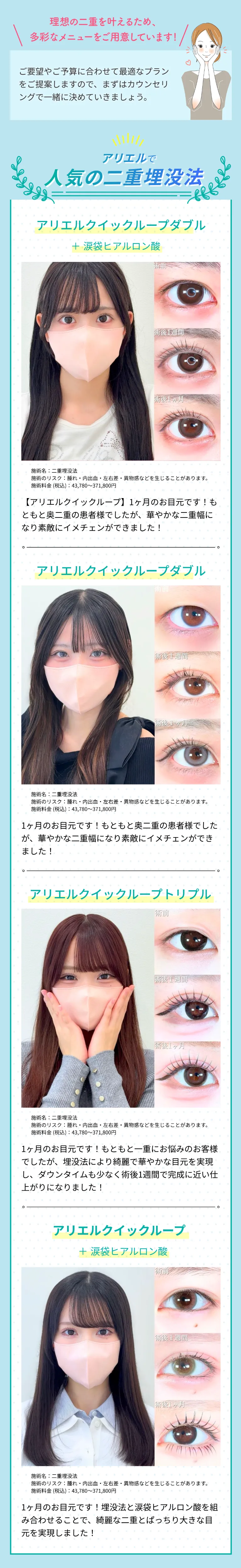 人気の二重埋没法メニュー紹介 アリエルクイックループダブル等の施術メニューと症例写真