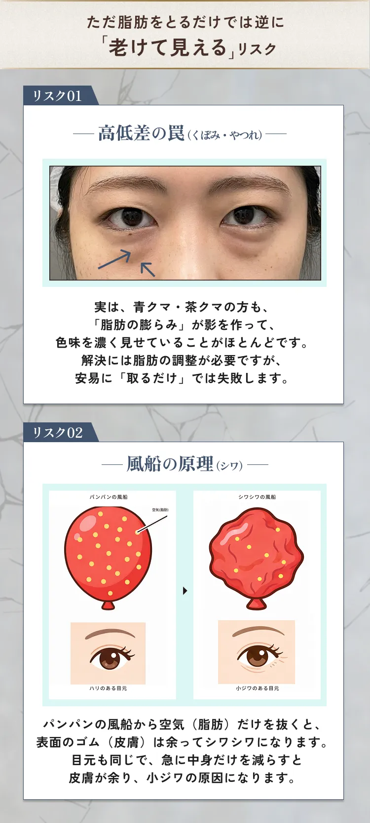 目の下のクマ・たるみ取り アリエル美容クリニック