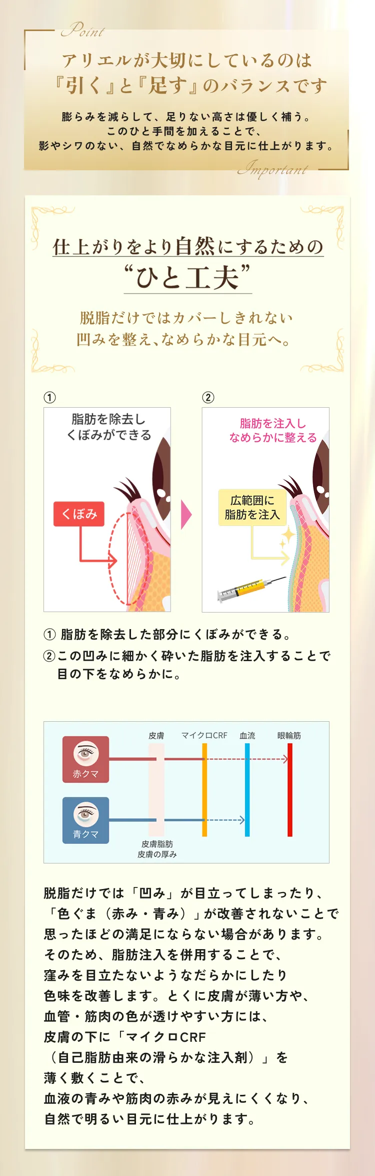 目の下のクマ・たるみ取り アリエル美容クリニック