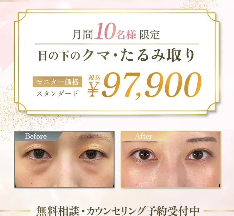 目の下のクマ・たるみ取り アリエル美容クリニック
