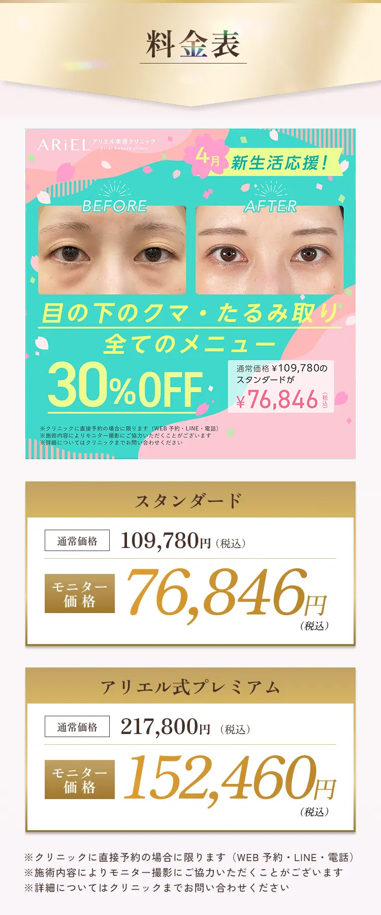 目の下のクマ・たるみ取り アリエル美容クリニック