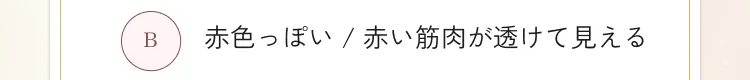 目の下のクマ・たるみ取り アリエル美容クリニック