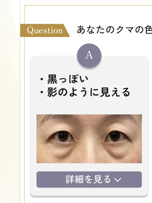 目の下のクマ・たるみ取り アリエル美容クリニック