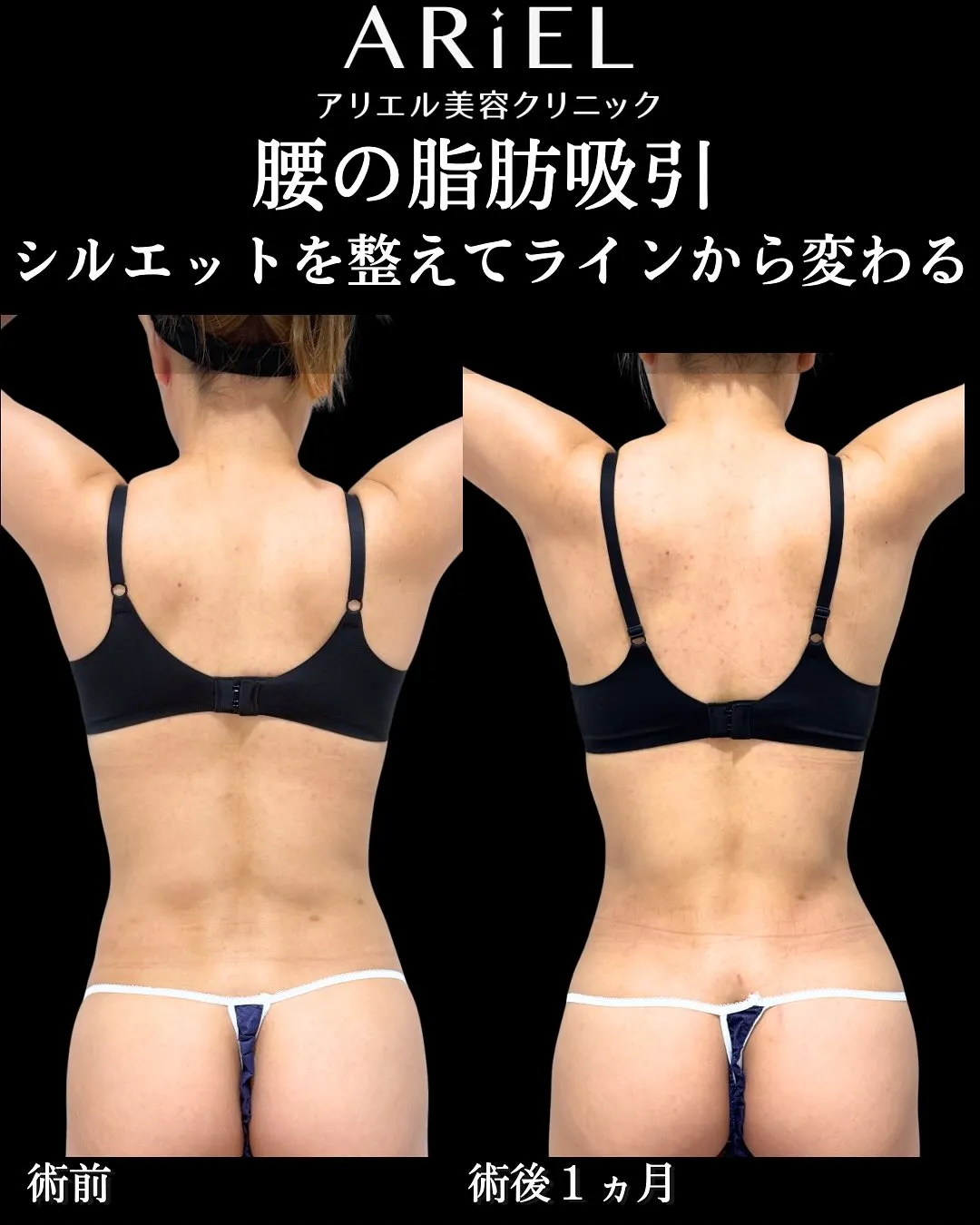 症例写真