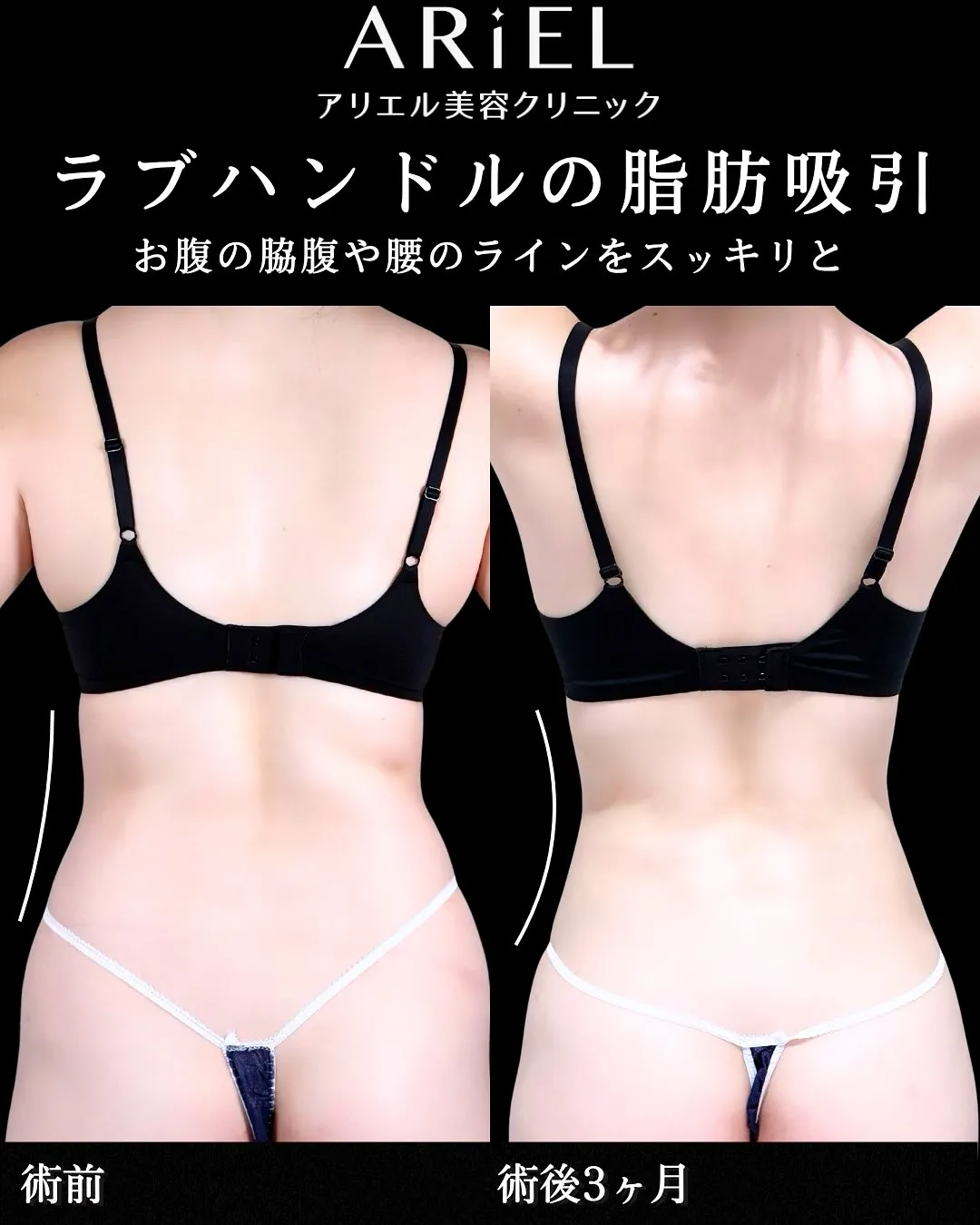 症例写真