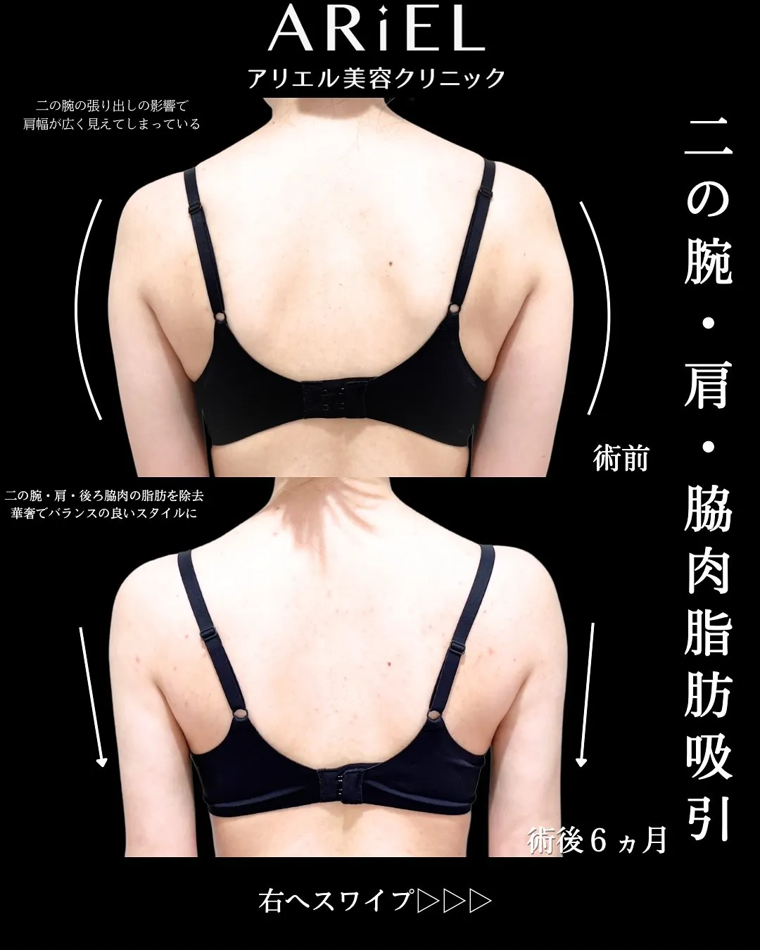 症例写真