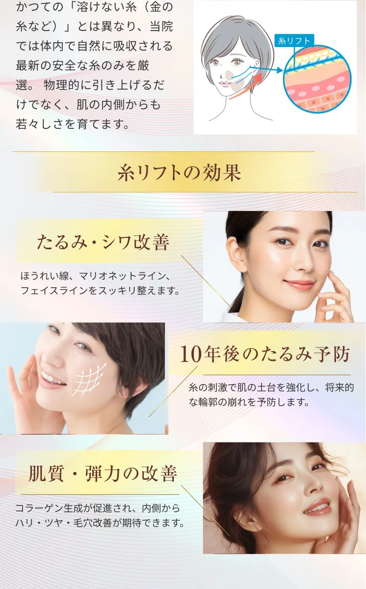 糸リフト アリエル美容クリニック