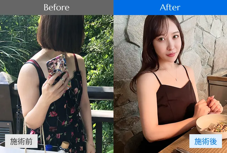 施術前後の写真