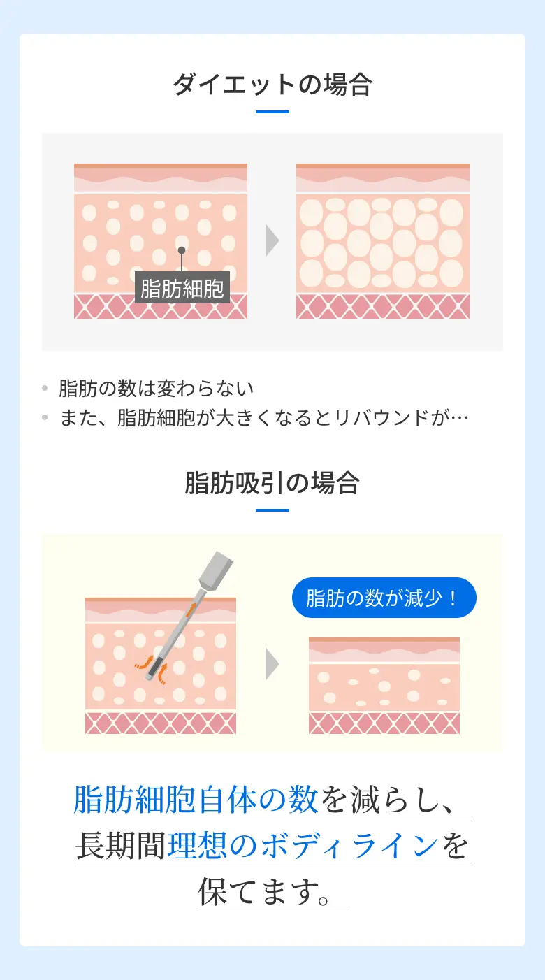 脂肪吸引の場合 脂肪細胞自体の数を減らし、長期間理想のフェイスラインを保てます。