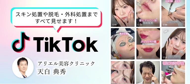 tiktok