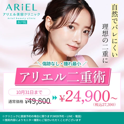 アリエル二重術（埋没法）