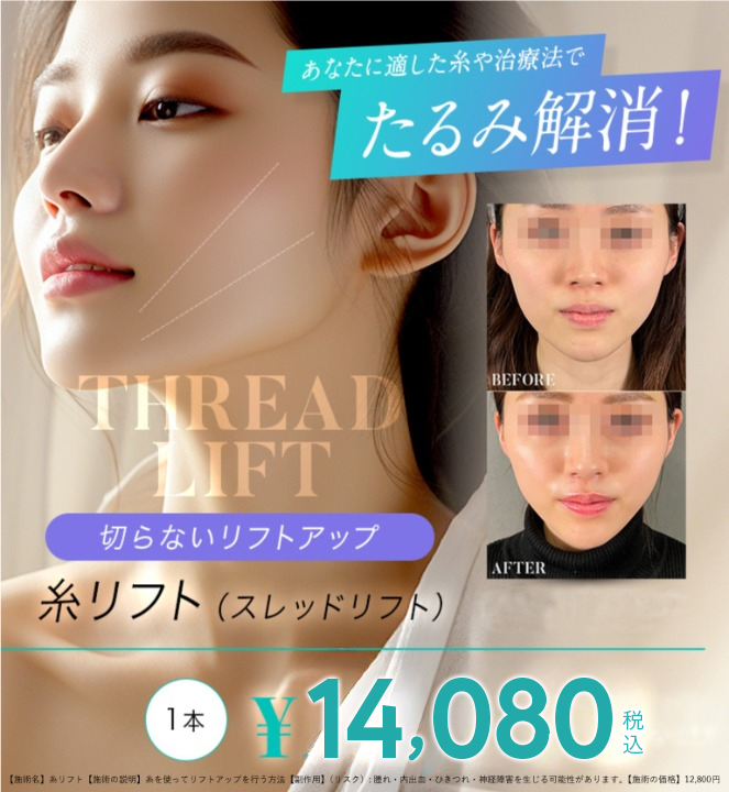 あなたに適した糸や治療法でたるみ解消！｜切らないリフトアップ-糸リフト(スレッドリフト)