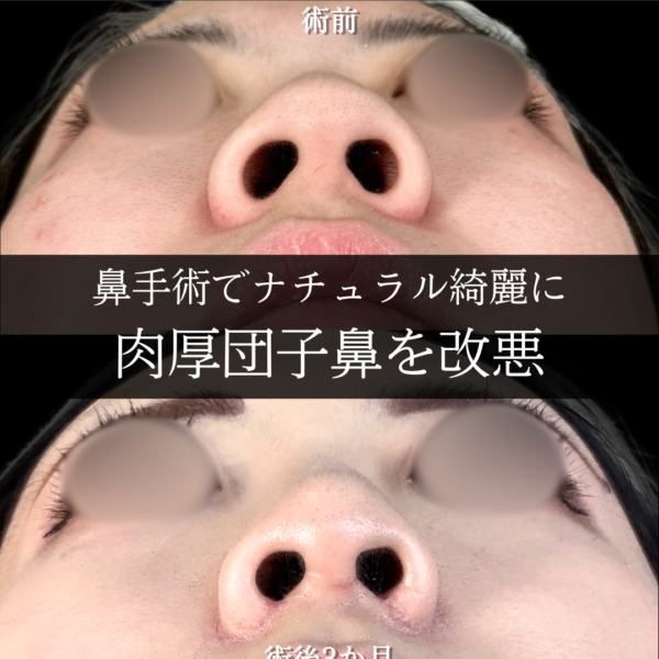 No.12442の症例写真