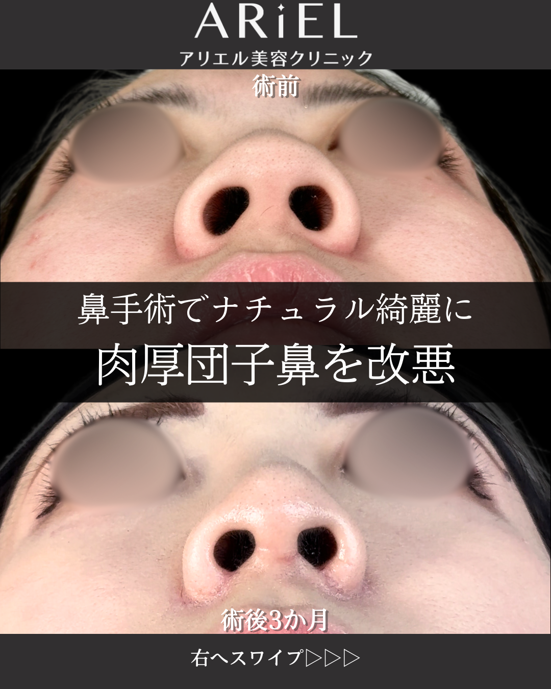 No.12442の症例写真