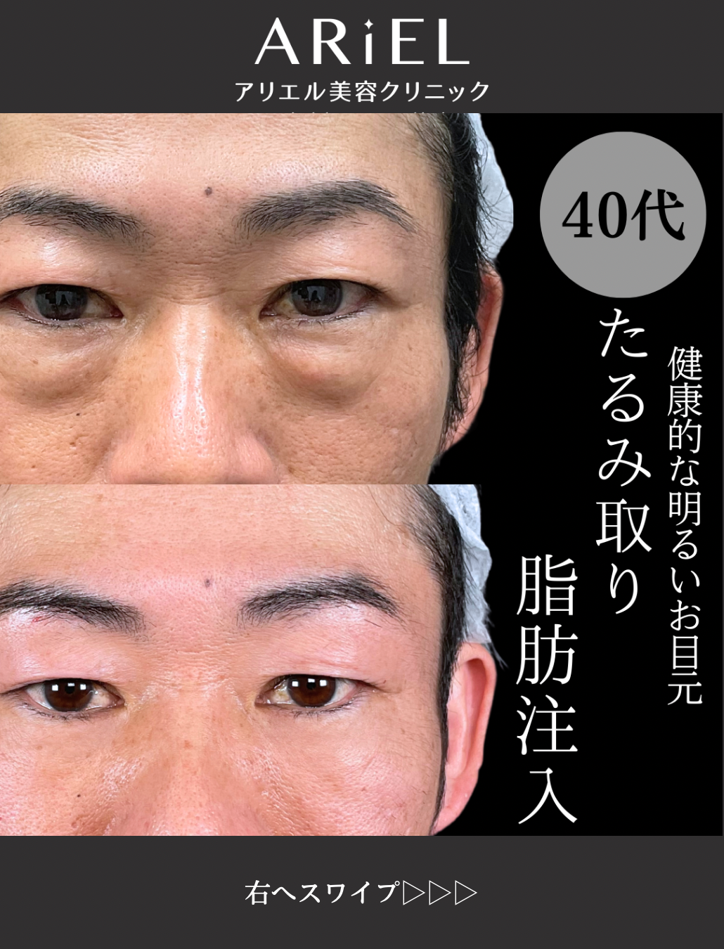 No.12562の症例写真