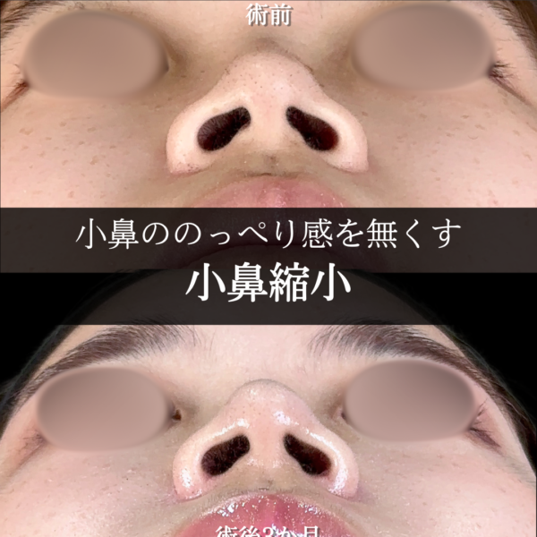 No.13069の症例写真