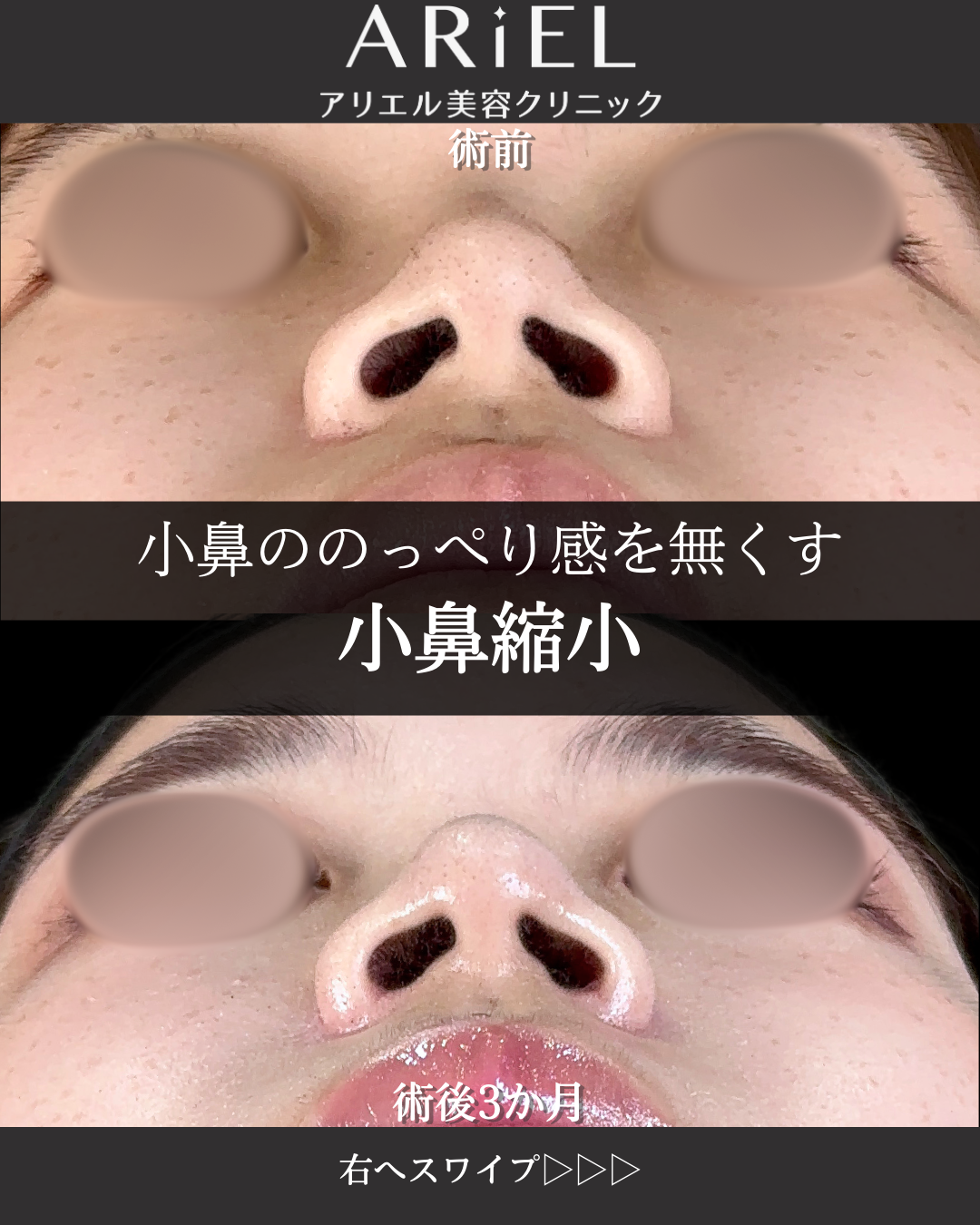 No.13069の症例写真