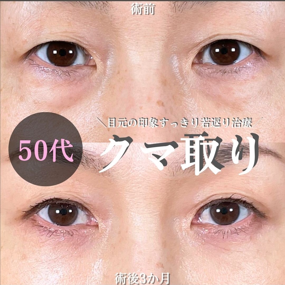 No.15536の症例写真 No.15536の症例写真