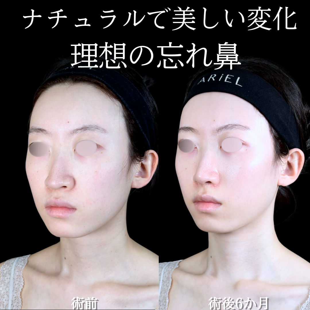No.15532の症例写真 No.15532の症例写真