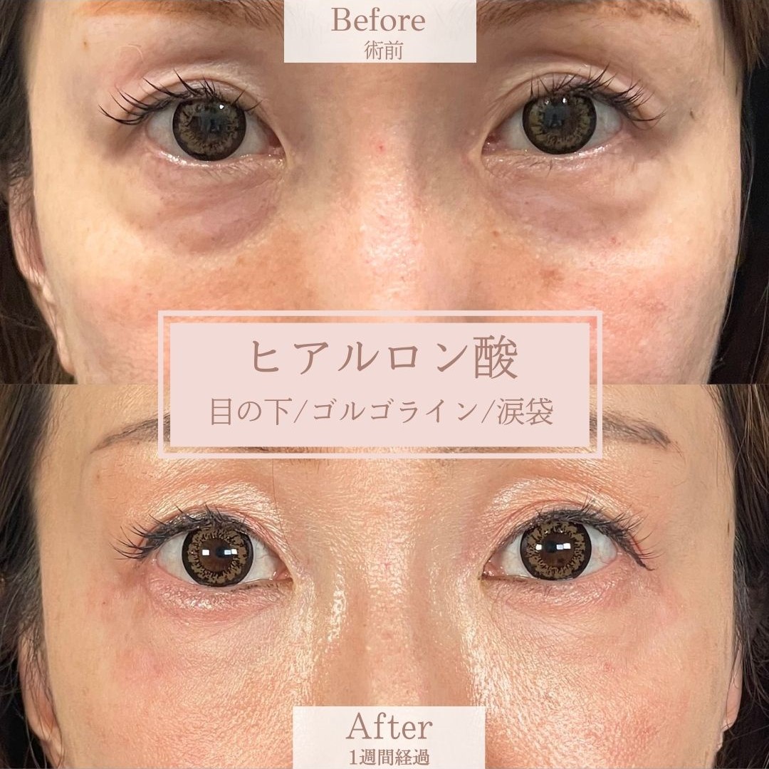 No.15806の症例写真 No.15806の症例写真