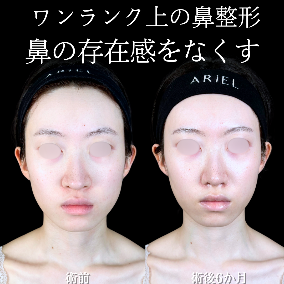 No.15548の症例写真 No.15548の症例写真