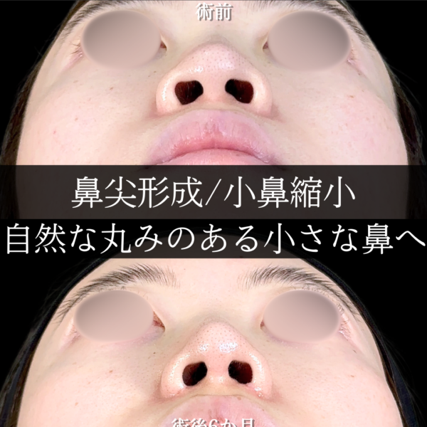No.15565の症例写真
