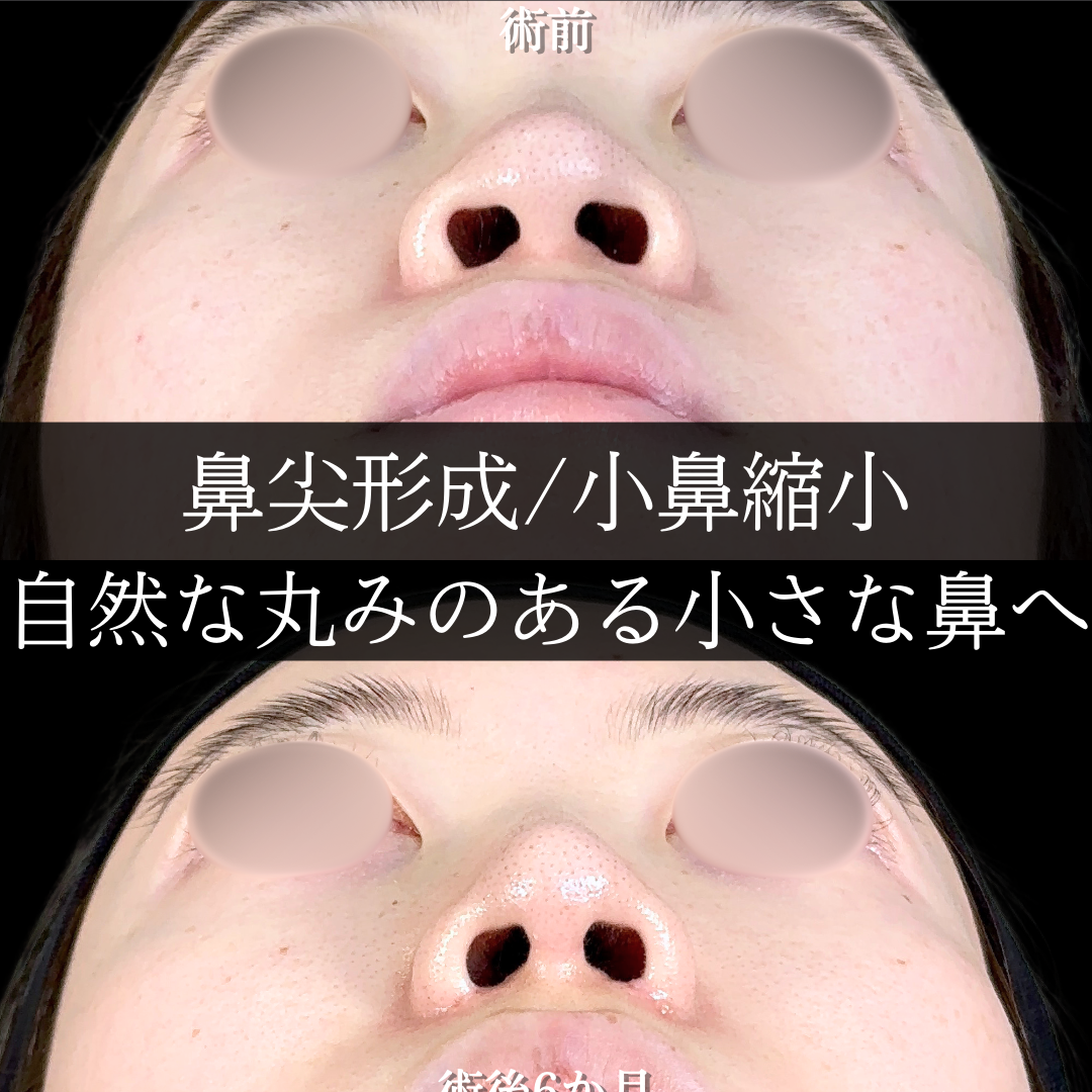 No.15565の症例写真 No.15565の症例写真
