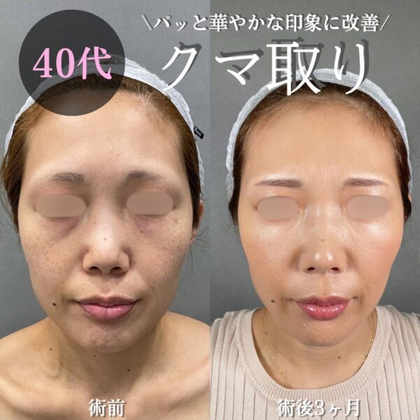 No.15562の症例写真