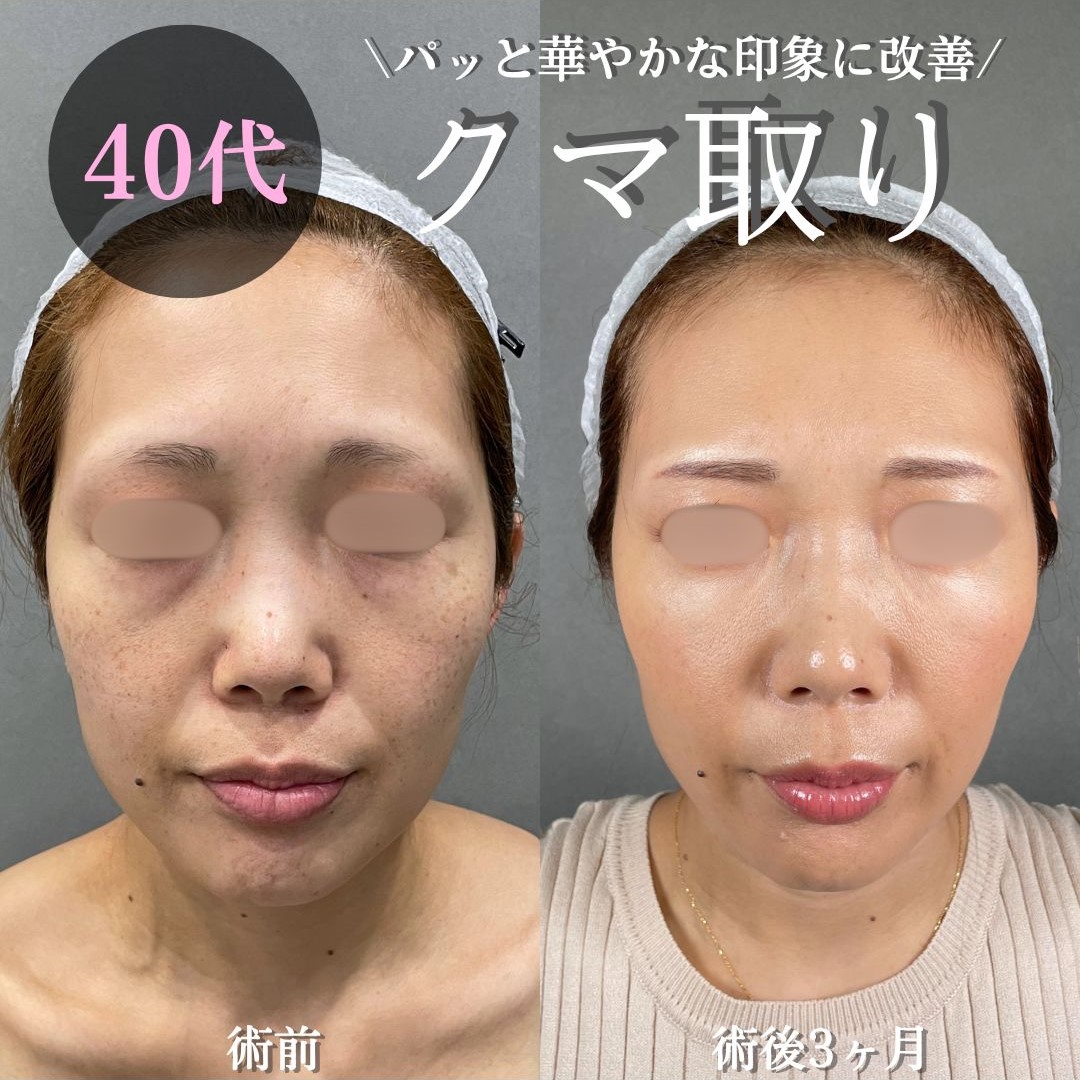 No.15562の症例写真 No.15562の症例写真